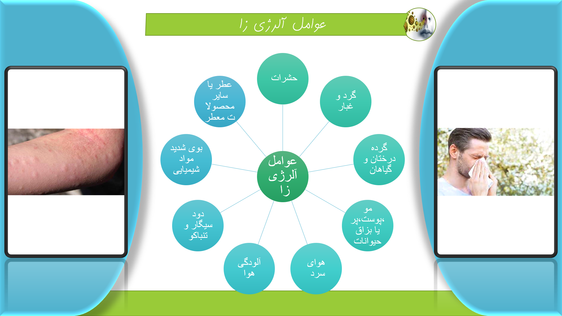 پاورپوینت حساسیت و علائم آن 